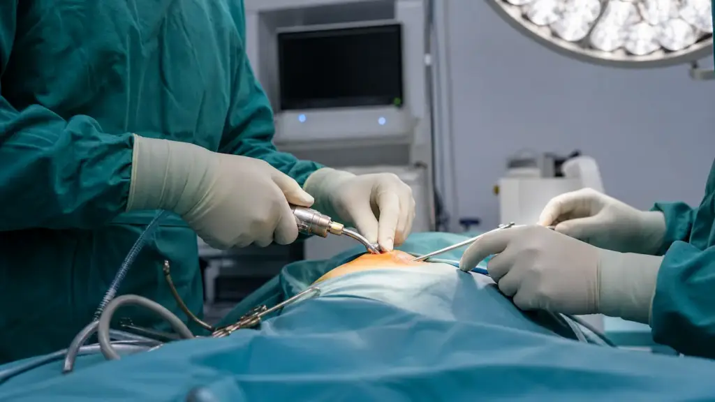 21 Acj Reconstruction 1